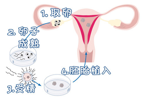 供卵代怀代生机构